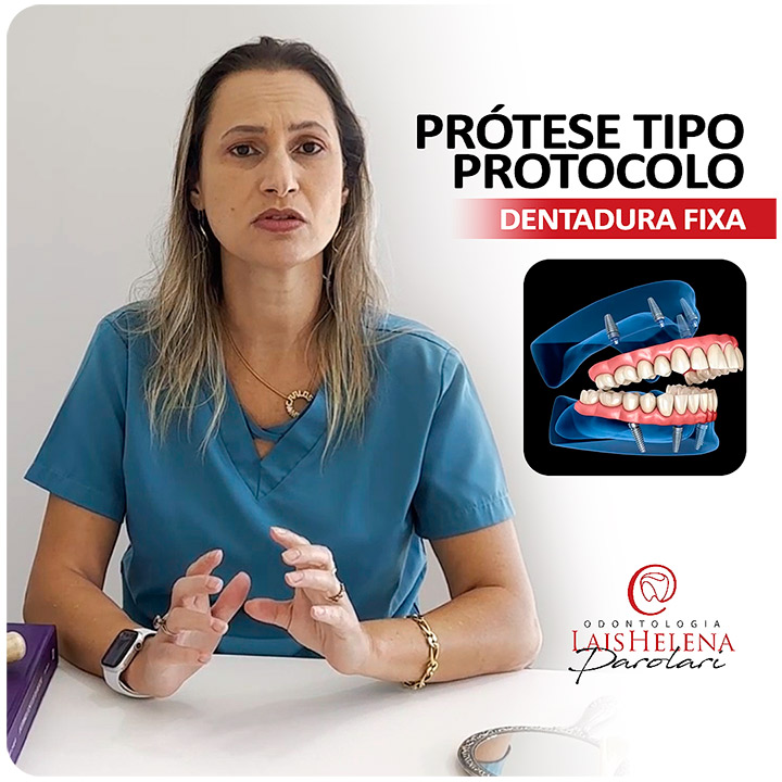 Dentadura Fixa ou Prótese Tipo Protocolo - Solução para fixação de todos os dentes de uma arcada